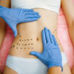 CIRURGIA PLASTICA