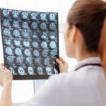 neurocirurgia